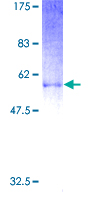 ab159087 on a 12.5% SDS-PAGE stained with Coomassie Blue.