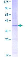 ab158825 on a 12.5% SDS-PAGE stained with Coomassie Blue.