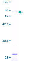 ab152980 on a 12.5% SDS-PAGE stained with Coomassie Blue.