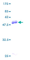 ab152266 on a 12.5% SDS-PAGE stained with Coomassie Blue.