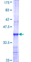 ab165899 on a 12.5% SDS-PAGE stained with Coomassie Blue.