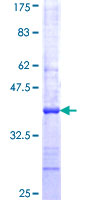 ab153611 on a 12.5% SDS-PAGE stained with Coomassie Blue.