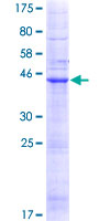 ab160861 on a 12.5% SDS-PAGE stained with Coomassie Blue.