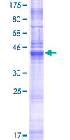 ab165995 on a 12.5% SDS-PAGE stained with Coomassie Blue.