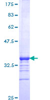 ab152972 on a 12.5% SDS-PAGE stained with Coomassie Blue.
