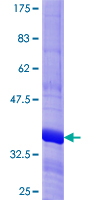 ab153276 on a 12.5% SDS-PAGE stained with Coomassie Blue.