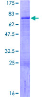 ab163448 on a 12.5% SDS-PAGE stained with Coomassie Blue.