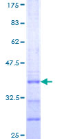 ab163449 on a 12.5% SDS-PAGE stained with Coomassie Blue.