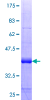 ab163450 on a 12.5% SDS-PAGE stained with Coomassie Blue.