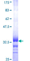 ab161252 on a 12.5% SDS-PAGE stained with Coomassie Blue.