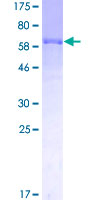 ab161250 on a 12.5% SDS-PAGE stained with Coomassie Blue.
