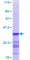 ab161251 on a 12.5% SDS-PAGE stained with Coomassie Blue.