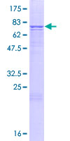 ab161681 on a 12.5% SDS-PAGE stained with Coomassie Blue.