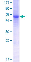 ab166353 on a 12.5% SDS-PAGE stained with Coomassie Blue.