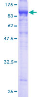 ab160928 on a 12.5% SDS-PAGE stained with Coomassie Blue.