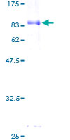 ab161237 on a 12.5% SDS-PAGE stained with Coomassie Blue.