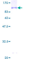 ab161226 on a 12.5% SDS-PAGE stained with Coomassie Blue.