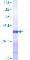 ab158818 on a 12.5% SDS-PAGE stained with Coomassie Blue.
