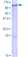 ab158820 on a 12.5% SDS-PAGE stained with Coomassie Blue.