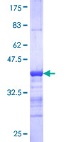 ab158821 on a 12.5% SDS-PAGE stained with Coomassie Blue.
