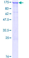 ab161495 on a 12.5% SDS-PAGE stained with Coomassie Blue.
