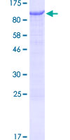 ab160285 on a 12.5% SDS-PAGE stained with Coomassie Blue.