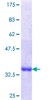 ab160286 on a 12.5% SDS-PAGE stained with Coomassie Blue.