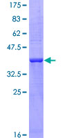 ab158058 on a 12.5% SDS-PAGE stained with Coomassie Blue.
