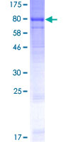 ab153558 on a 12.5% SDS-PAGE stained with Coomassie Blue.