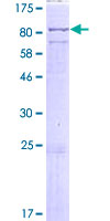 ab165693 on a 12.5% SDS-PAGE stained with Coomassie Blue.