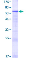 ab163002 on a 12.5% SDS-PAGE stained with Coomassie Blue.