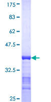 ab160085 on a 12.5% SDS-PAGE stained with Coomassie Blue.