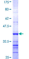 ab160068 on a 12.5% SDS-PAGE stained with Coomassie Blue.