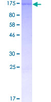 ab153205 on a 12.5% SDS-PAGE stained with Coomassie Blue.
