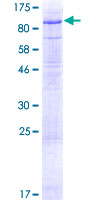 ab162604 on a 12.5% SDS-PAGE stained with Coomassie Blue.