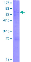 ab162605 on a 12.5% SDS-PAGE stained with Coomassie Blue.
