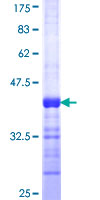 ab152587 on a 12.5% SDS-PAGE stained with Coomassie Blue.