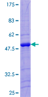 ab152995 on a 12.5% SDS-PAGE stained with Coomassie Blue.