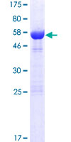 ab165795 on a 12.5% SDS-PAGE stained with Coomassie Blue.