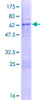 ab153146 on a 12.5% SDS-PAGE stained with Coomassie Blue.