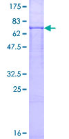 ab163818 on a 12.5% SDS-PAGE stained with Coomassie Blue.