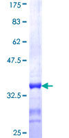 ab163819 on a 12.5% SDS-PAGE stained with Coomassie Blue.