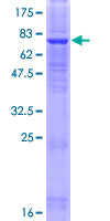 ab163188 on a 12.5% SDS-PAGE stained with Coomassie Blue.