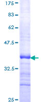 ab158823 on a 12.5% SDS-PAGE stained with Coomassie Blue.