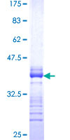ab165031 on a 12.5% SDS-PAGE stained with Coomassie Blue.
