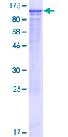 ab165660 on a 12.5% SDS-PAGE stained with Coomassie Blue.