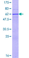ab166204 on a 12.5% SDS-PAGE stained with Coomassie Blue.