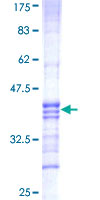 ab166205 on a 12.5% SDS-PAGE stained with Coomassie Blue.