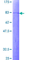 ab164868 on a 12.5% SDS-PAGE stained with Coomassie Blue.
