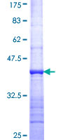 ab164869 on a 12.5% SDS-PAGE stained with Coomassie Blue.